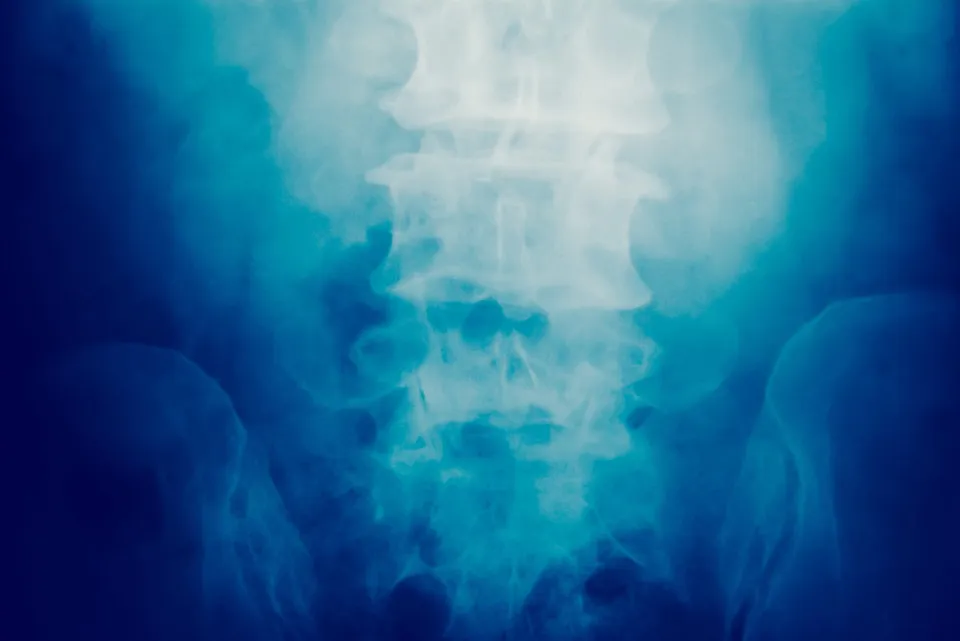 Who Might Be Liable for My Spinal Cord Injury?